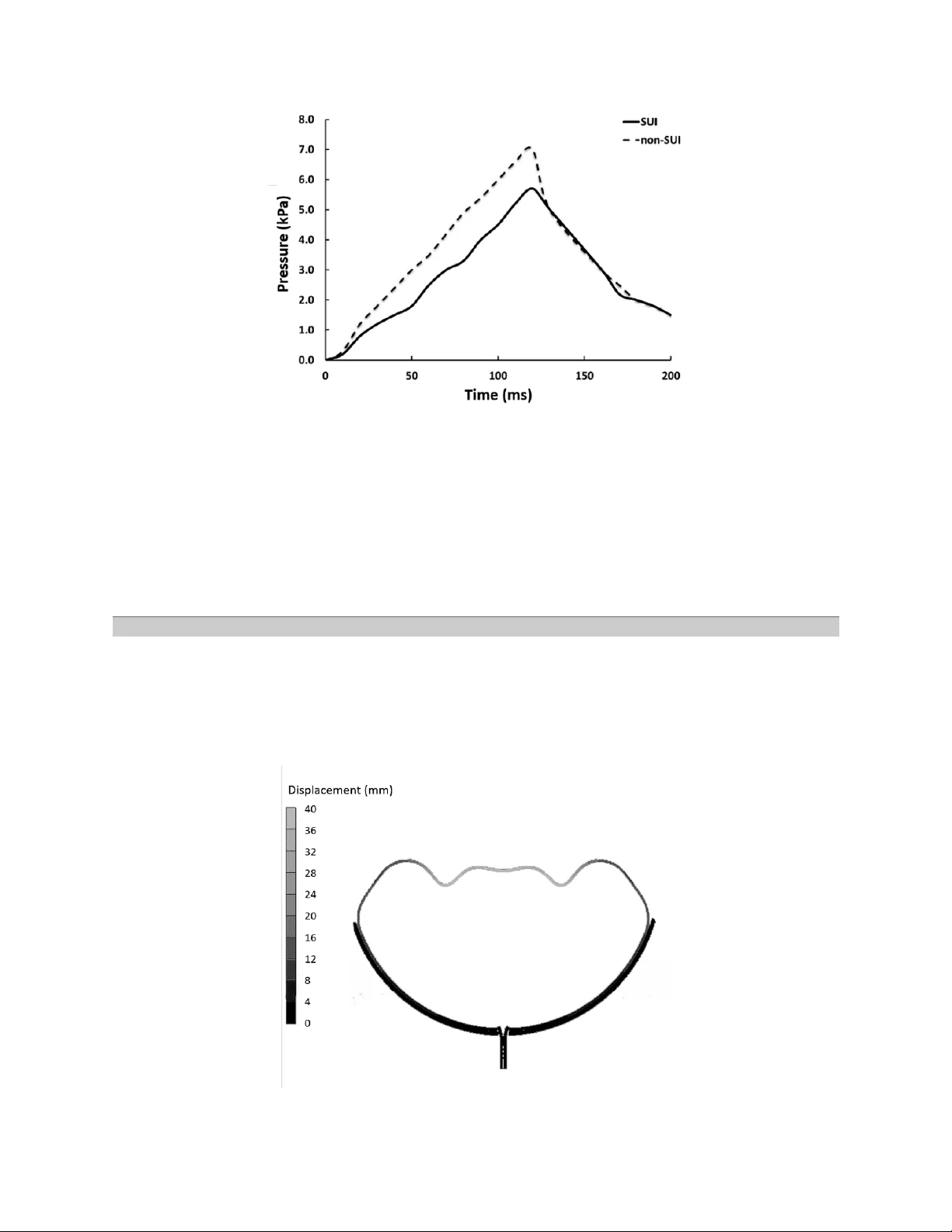 A Clinical and Finite Elements Study of Stress Urinary Incontinence in   Women Using Fluid-Structure Interactions