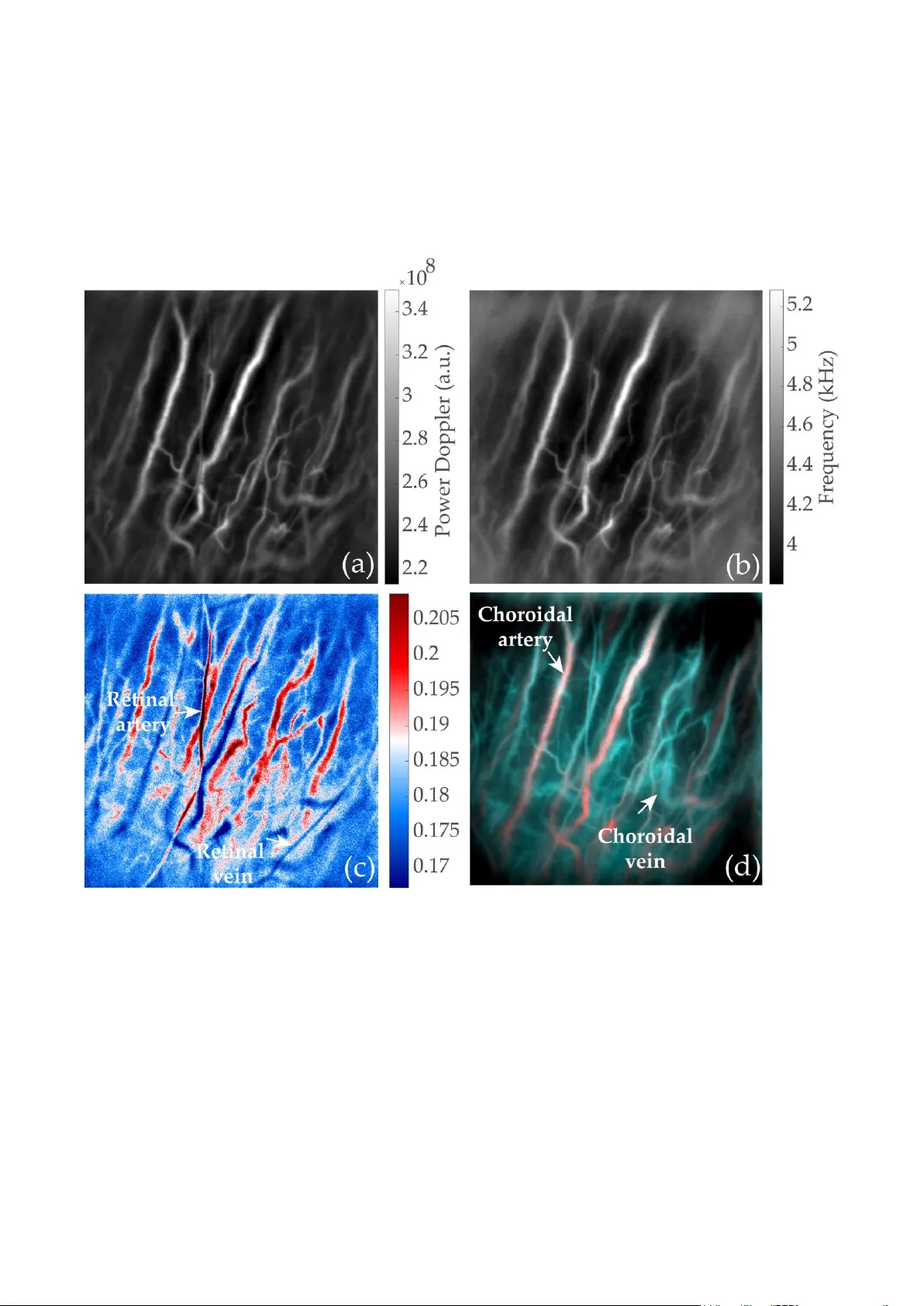 레이저 도플러 홀로그래피 망막 맥락막 혈류 구분