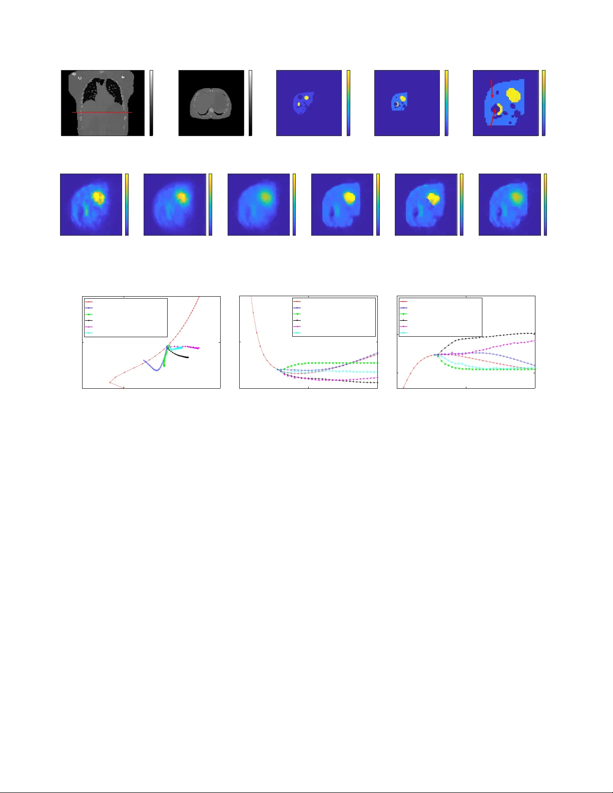 저카운트 PET 재구성을 위한 반복 신경망 개선