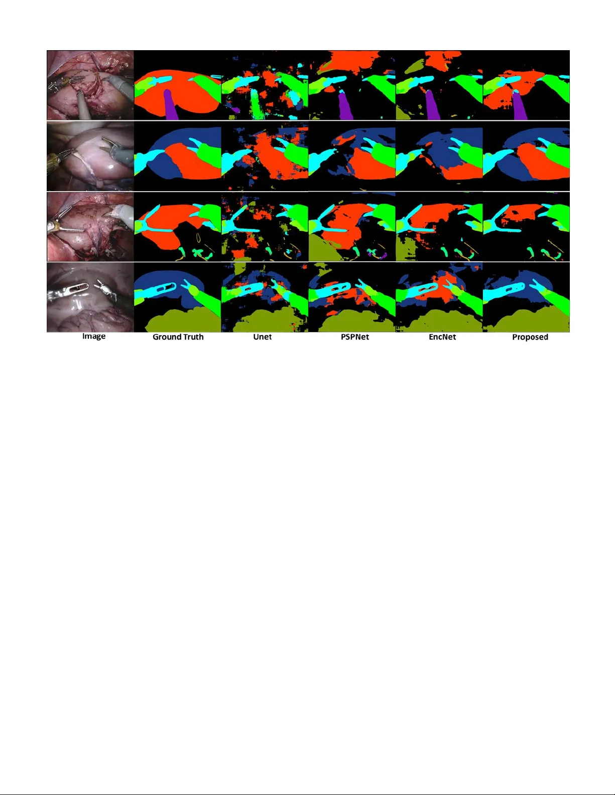 Task Decomposition and Synchronization for Semantic Biomedical Image   Segmentation