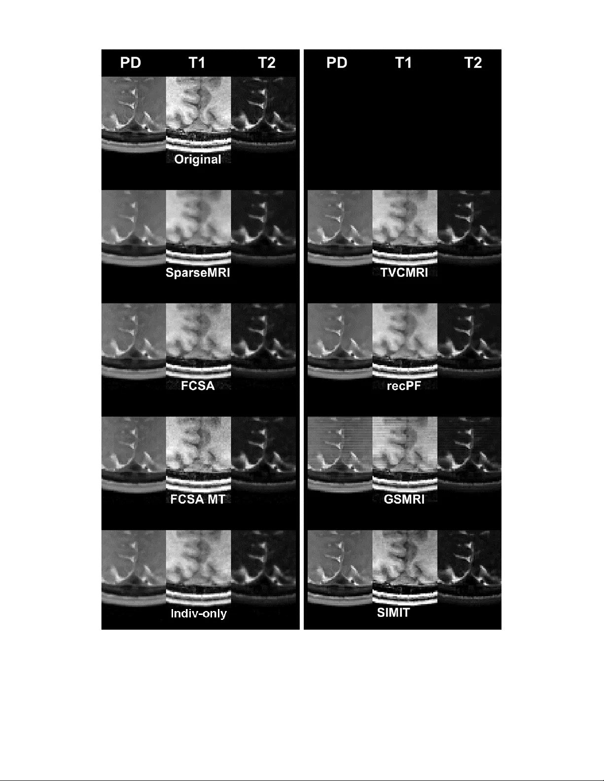 다중 대조 MRI 재구성에서 특징 누출을 막는 개별 및 공동 정규화 기술