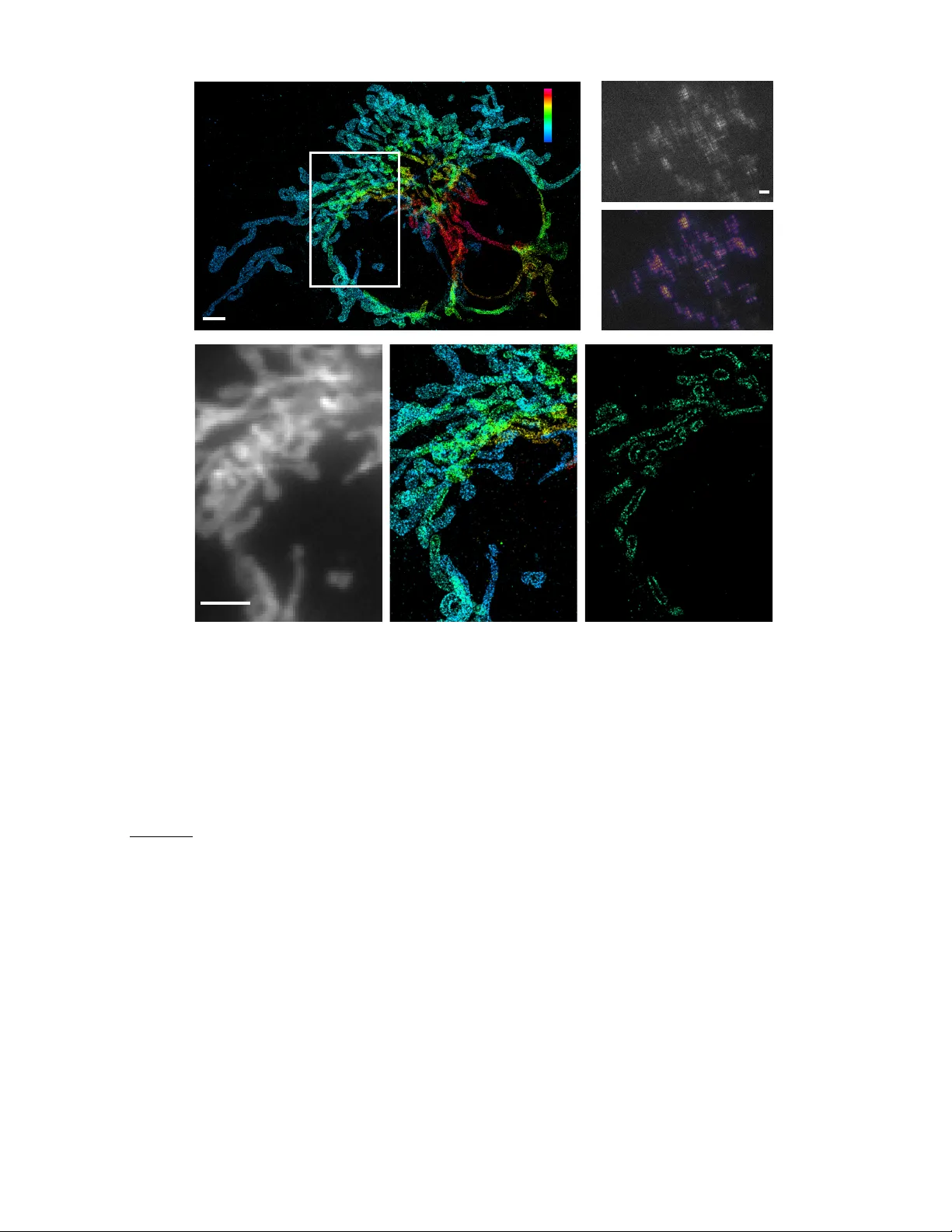 딥러닝 기반 고밀도 3D 현미경과 최적 PSF 설계