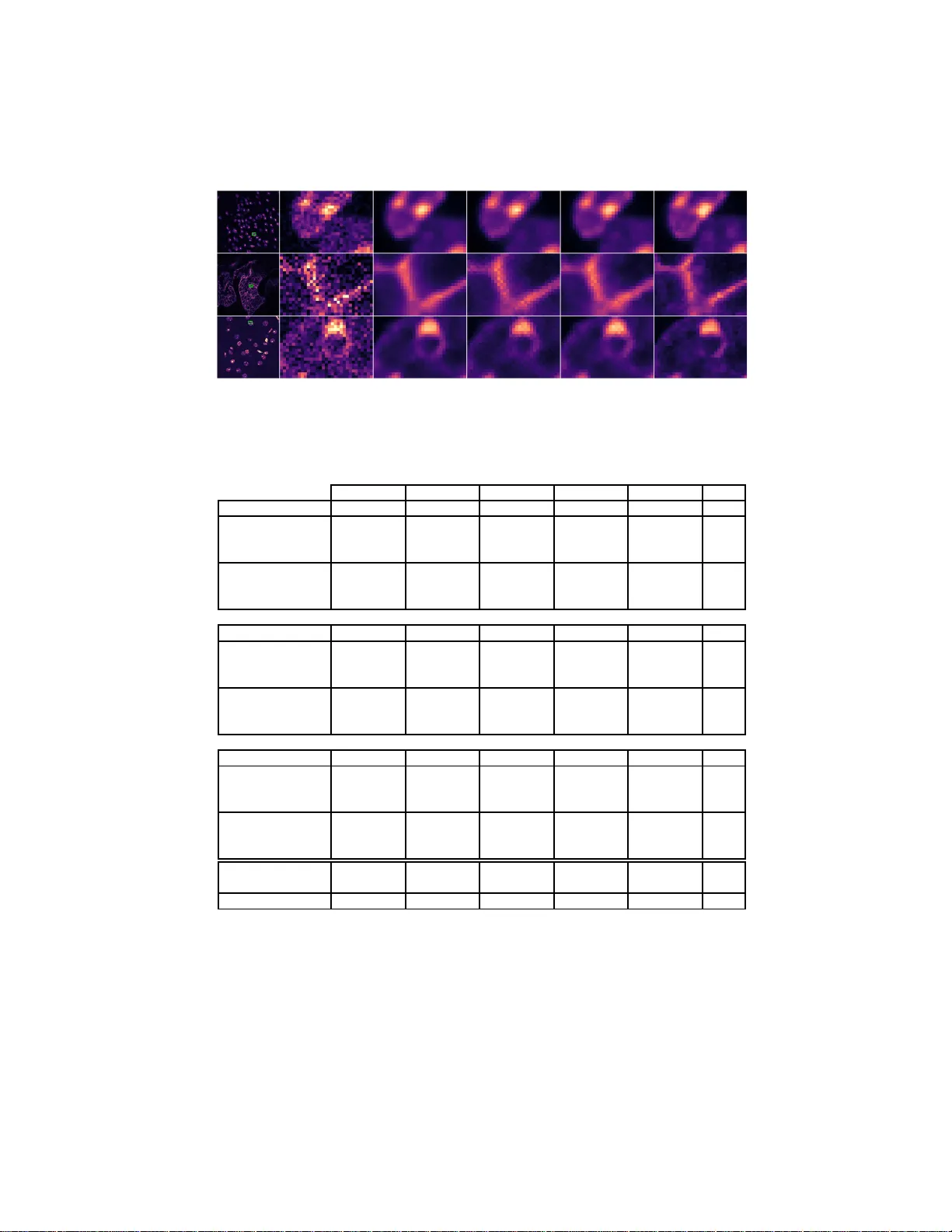 확률적 Noise2Void를 이용한 자가 지도 현미경 이미지 복원