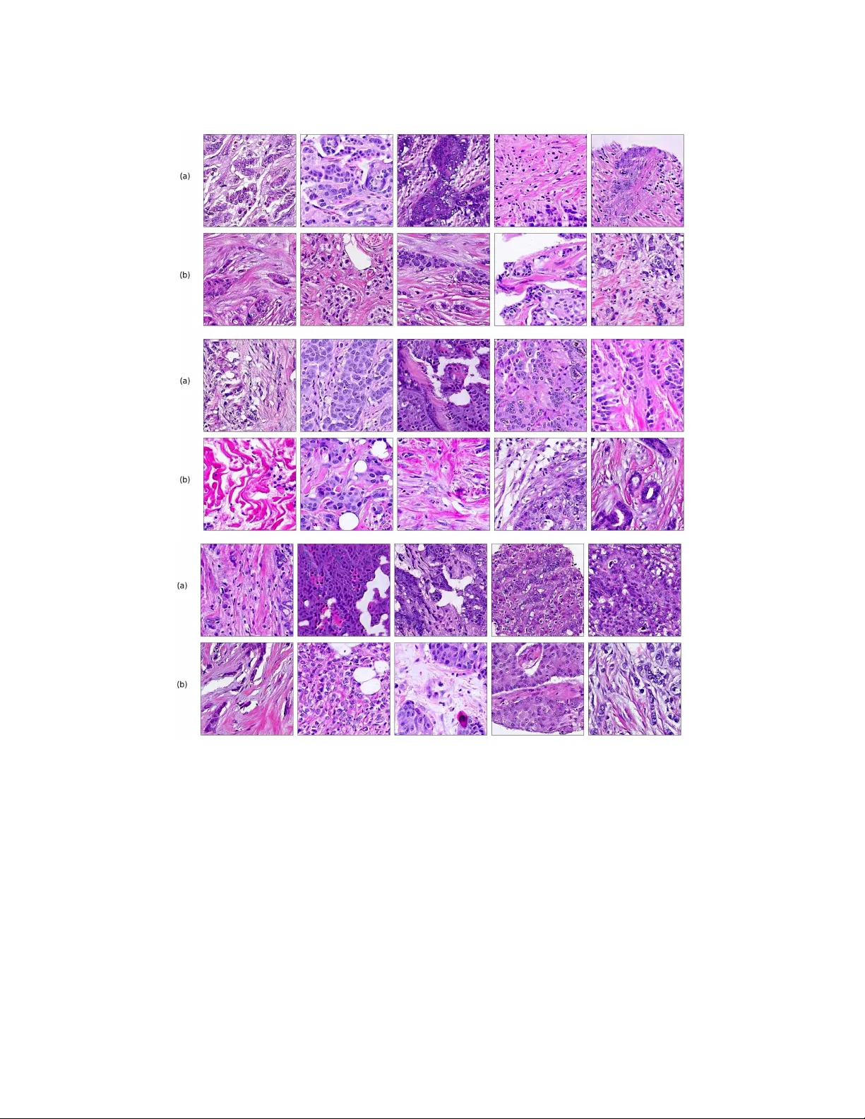 PathologyGAN 암 조직의 깊은 표현 학습