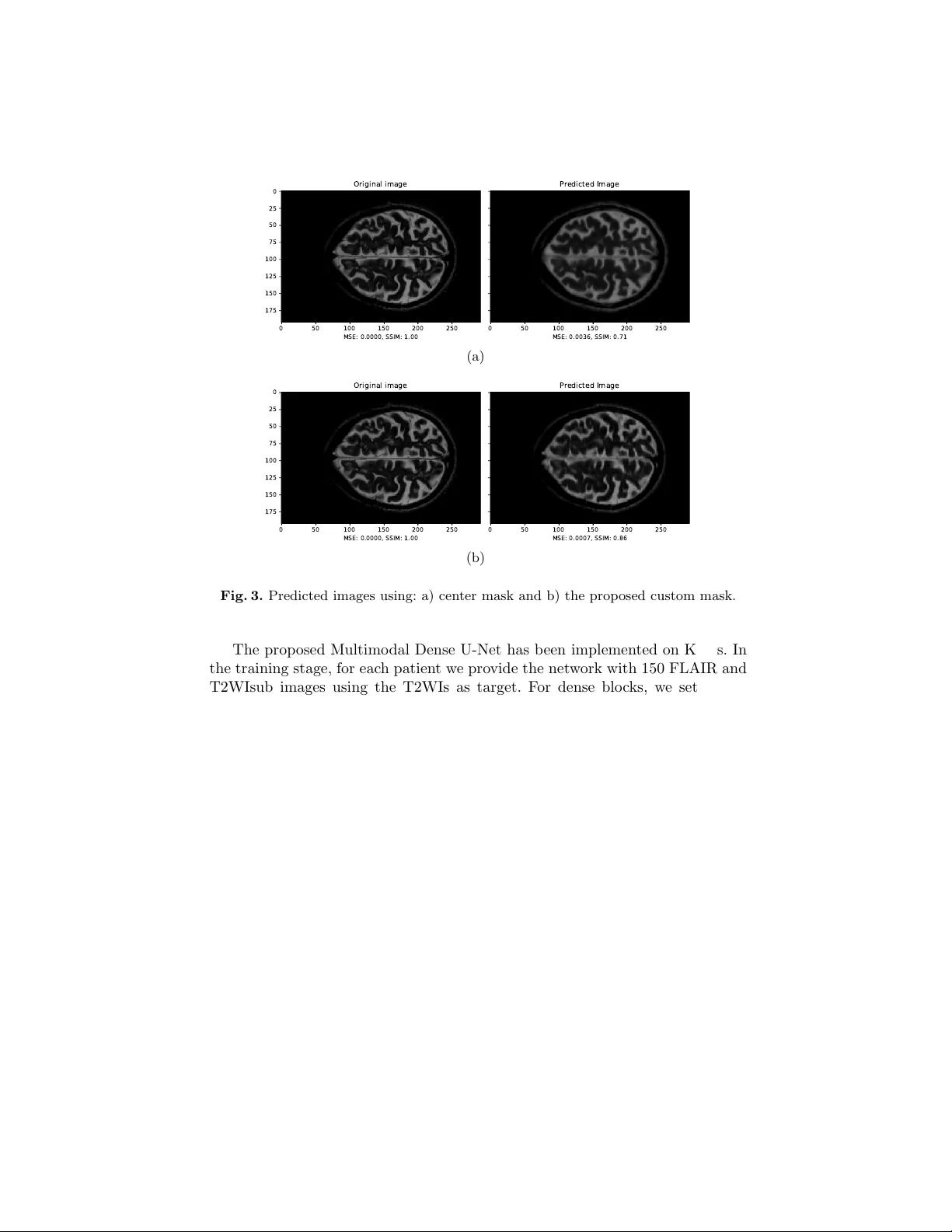 멀티모달 딥러닝을 활용한 T2W MRI 고속 재구성
