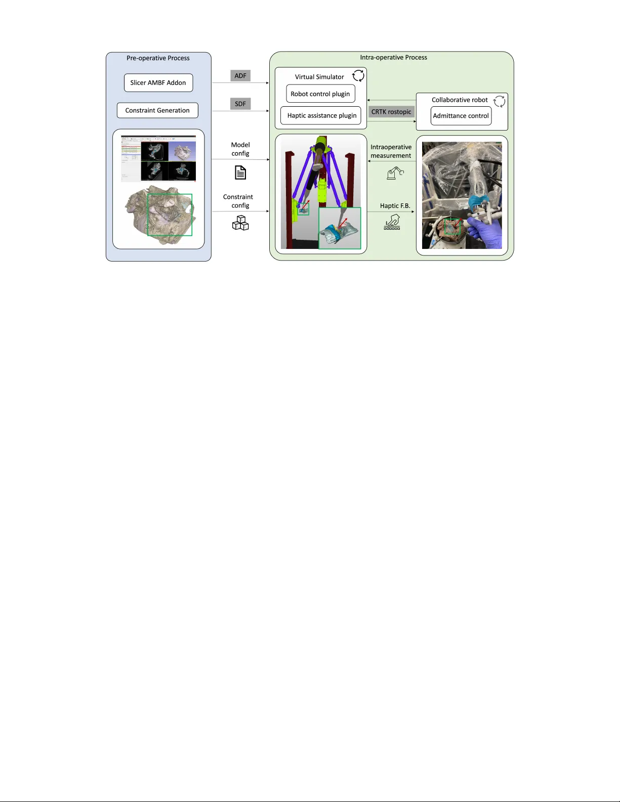 두뇌기저부 수술을 위한 촉각 보조 협동 로봇 프레임워크