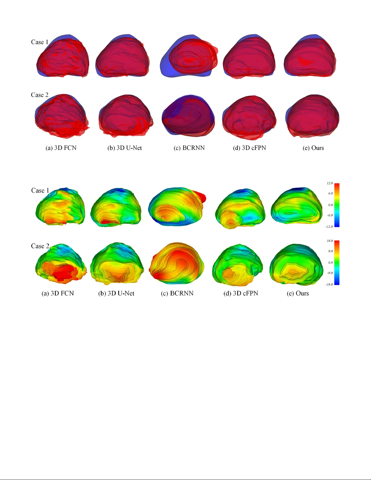 3D 초음파 전립선 분할을 위한 깊은 주의 특징