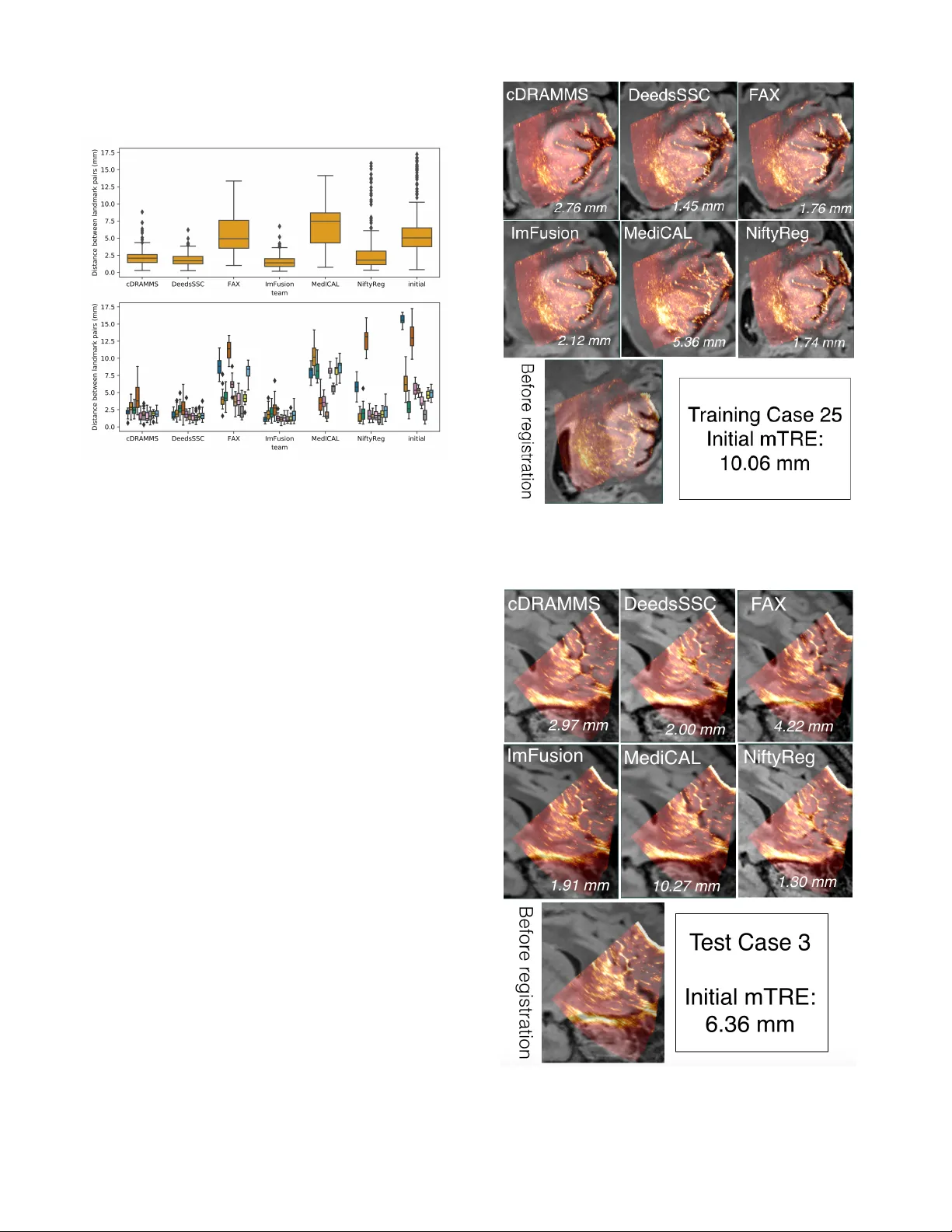 뇌이동 보정 위한 MRI‑초음파 정합 알고리즘 대회 평가 보고서