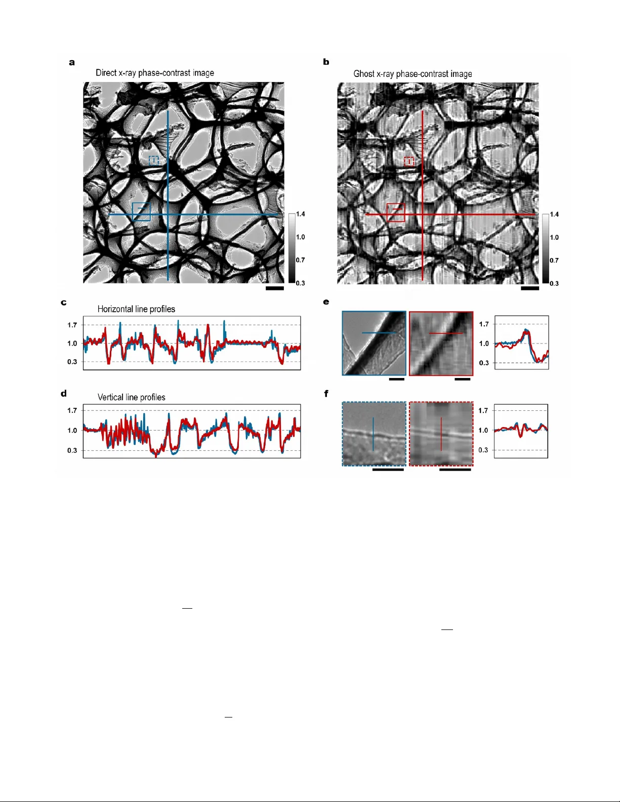 위상 민감 X 레이 고스트 이미징: 저용량·고해상도 혁신