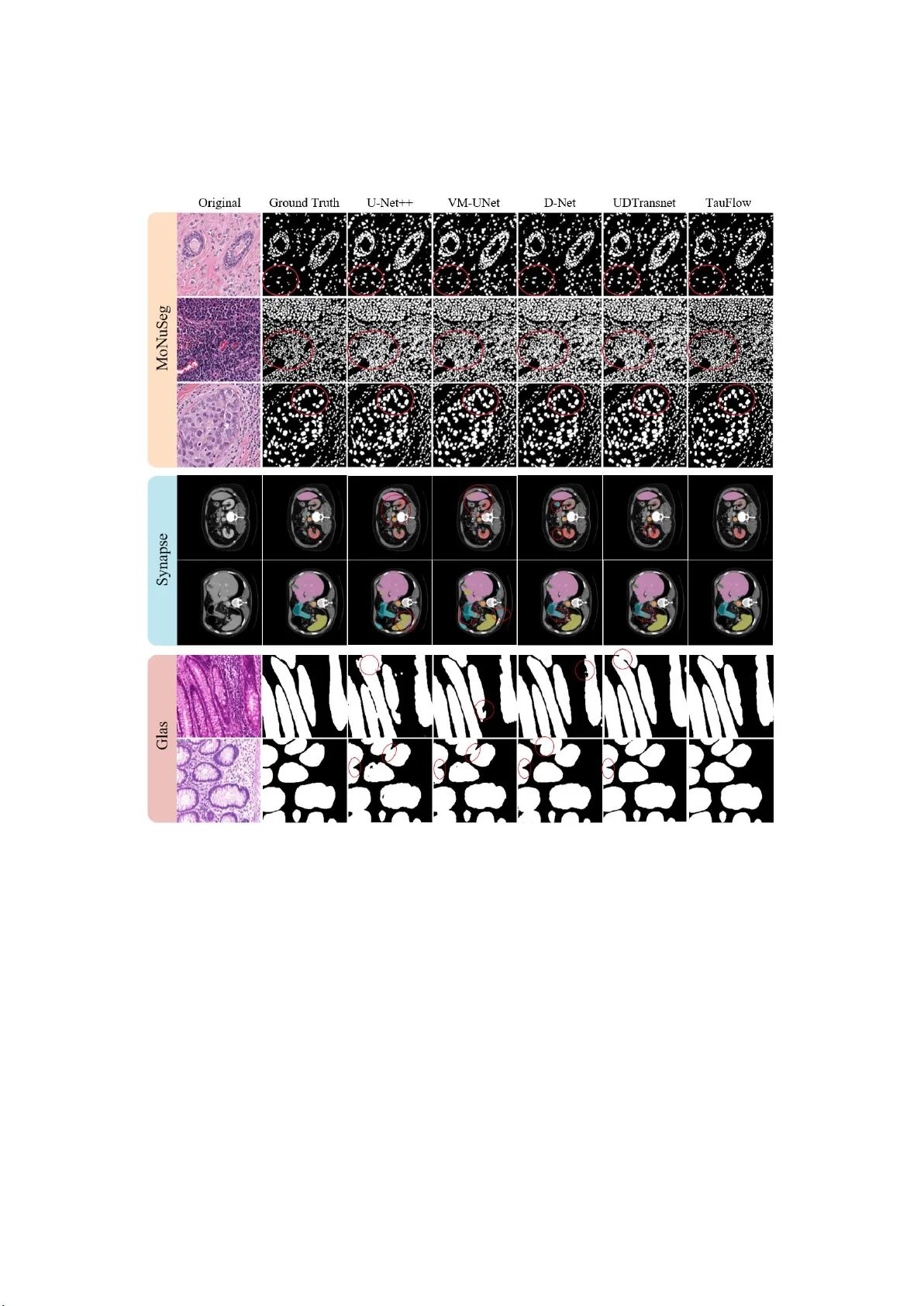 TauFlow: 뇌 영감 동적 시간 상수 기반 초경량 의료 영상 분할 모델