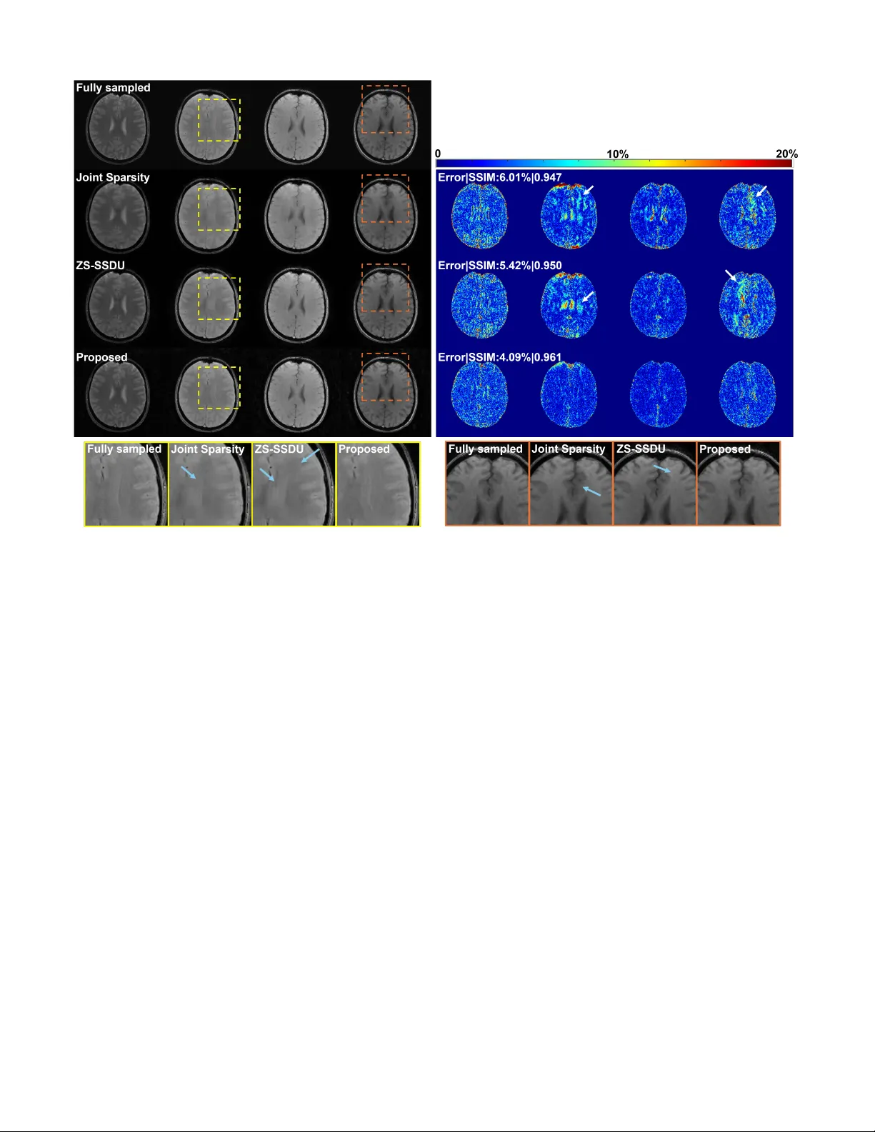 다차원 MRI 재구성을 위한 적응형 분리형 표현 학습