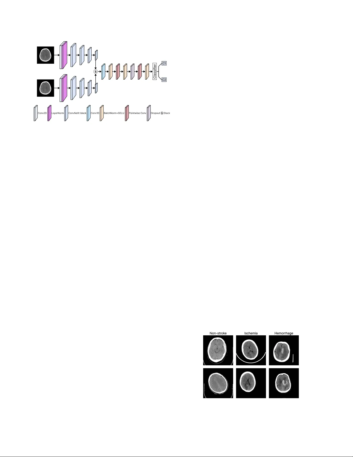 뇌졸중 CT 영상 분류를 위한 듀얼 인코더 StrokeNeXt 모델