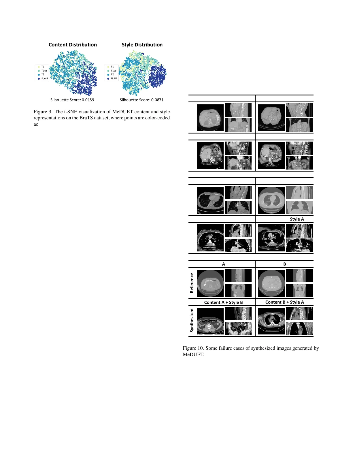 3D 의료 영상 통합 사전학습을 위한 MeDUET: 내용·스타일 분리와 토큰 디믹싱