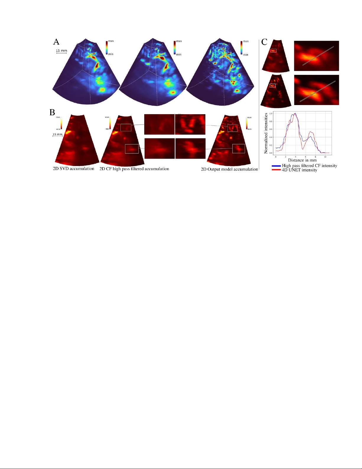 4D UNet 기반 두개골 초음파 클러터 제거 혁신