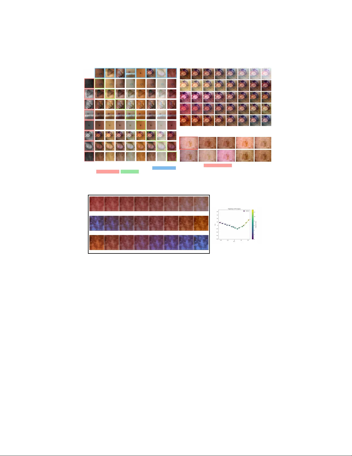 피부 병변 이미지의 색상 분리와 교정: 자동화된 피부색 해석 프레임워크