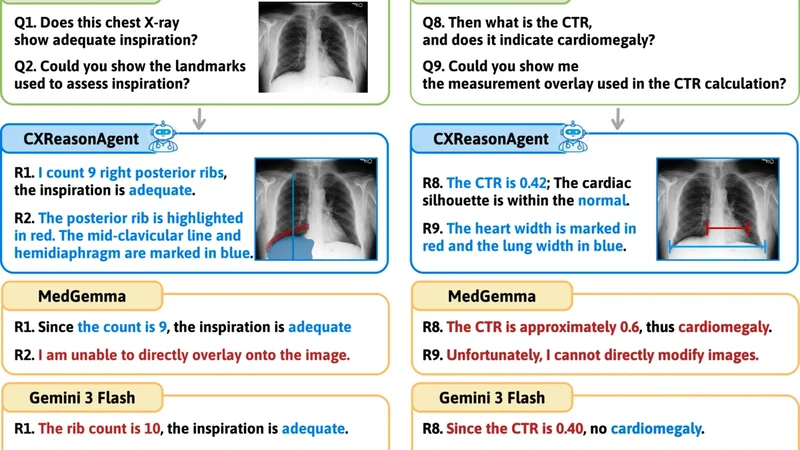 CXReasonAgent: Evidence-Grounded Diagnostic Reasoning Agent for Chest X-rays