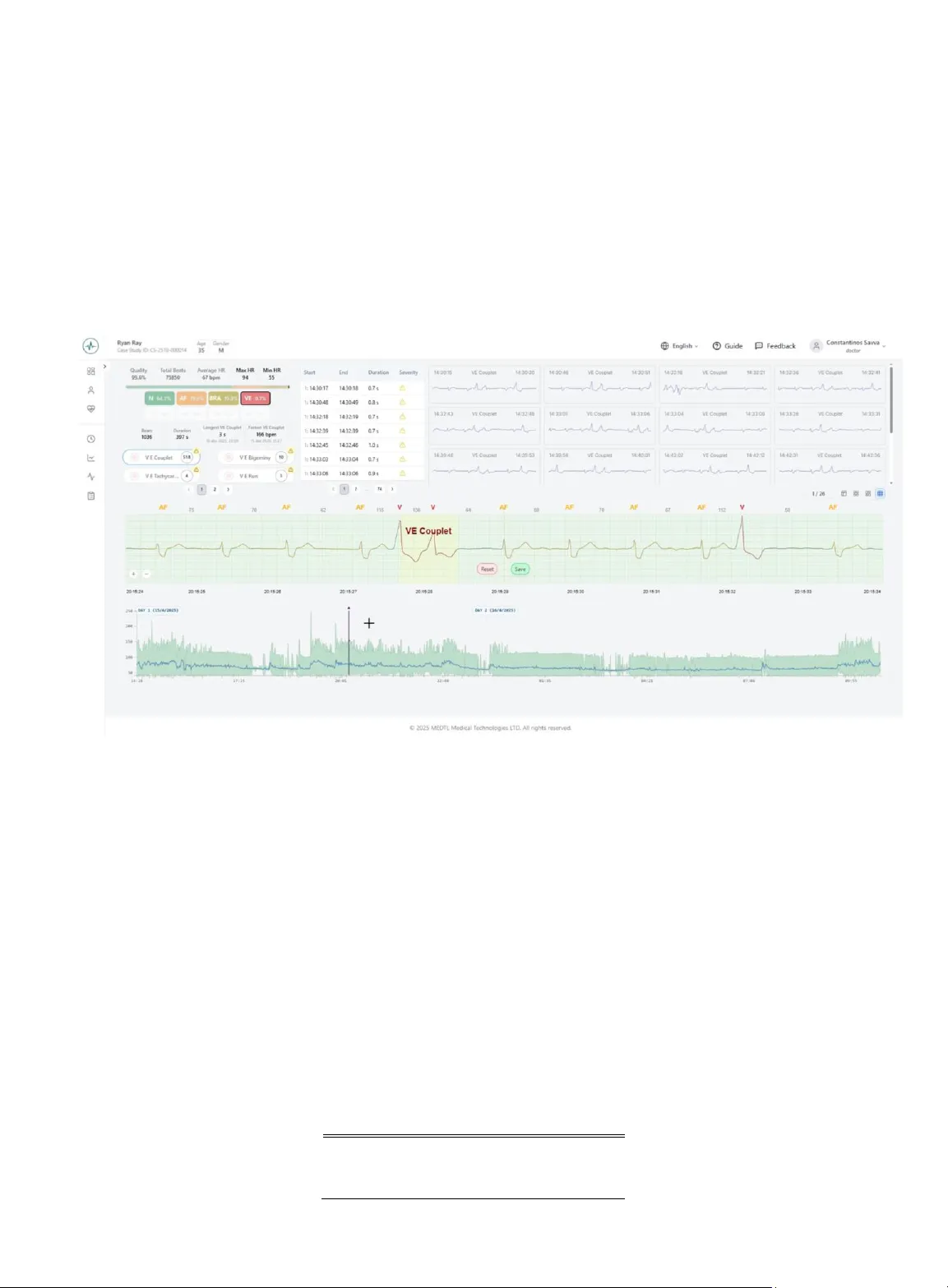 AIHEART 클라우드 기반 종단형 디지털 헬스 ECG 분석 시스템