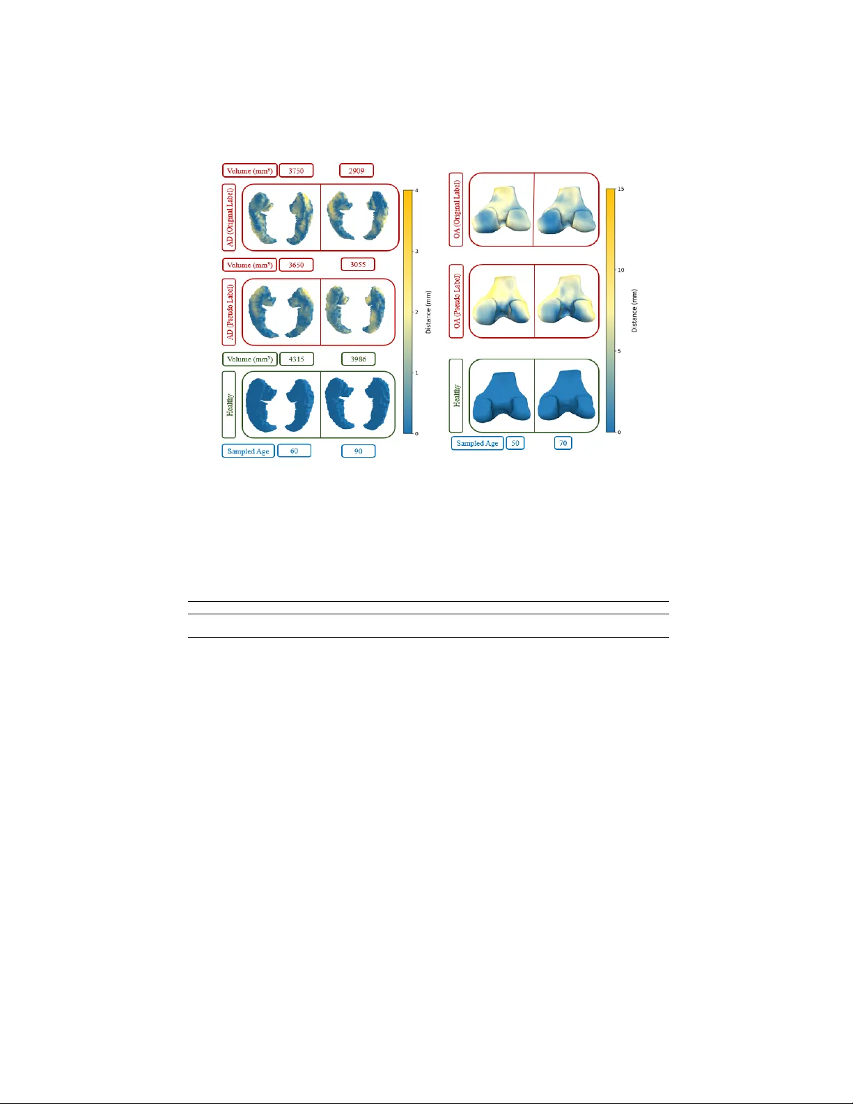 3D 의료 형태에서 노화와 질병 효과를 자동 분리하는 두 단계 프레임워크