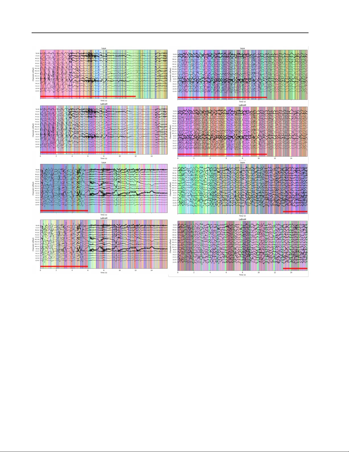 뇌전도 표현 학습의 새로운 패러다임 Laya