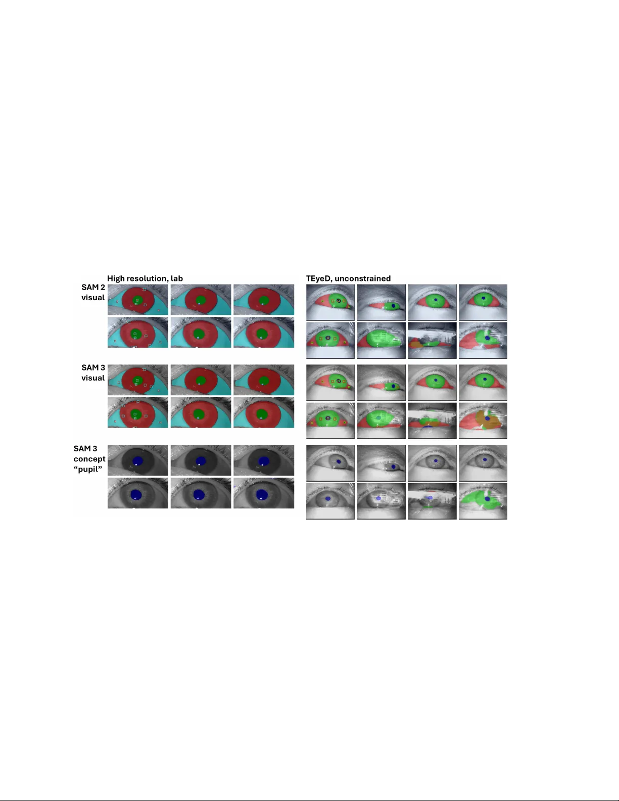 눈 이미지 분할에서 SAM3의 시각·텍스트 프롬프트 성능 평가