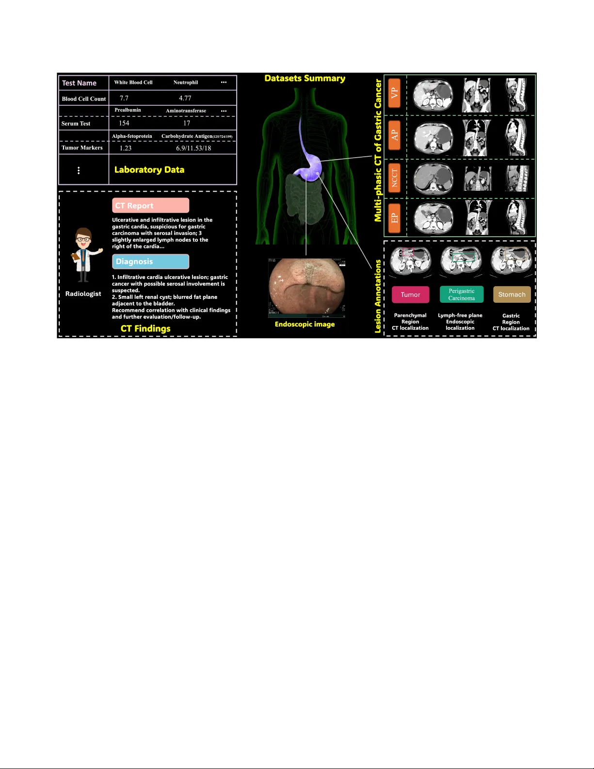 가스트릭‑X: 위암 진단을 위한 다중모달·멀티페이즈 대규모 벤치마크