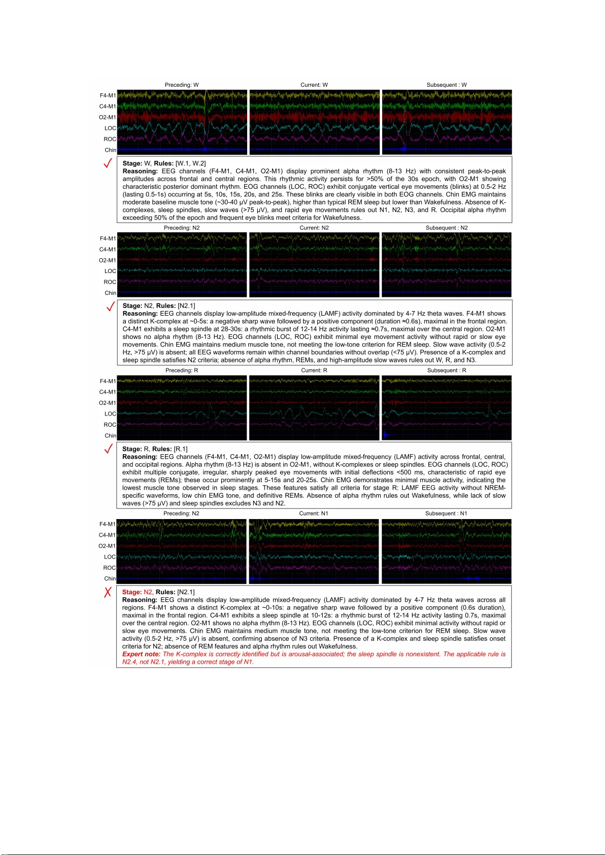 SleepVLM: Explainable and Rule-Grounded Sleep Staging via a Vision-Language Model