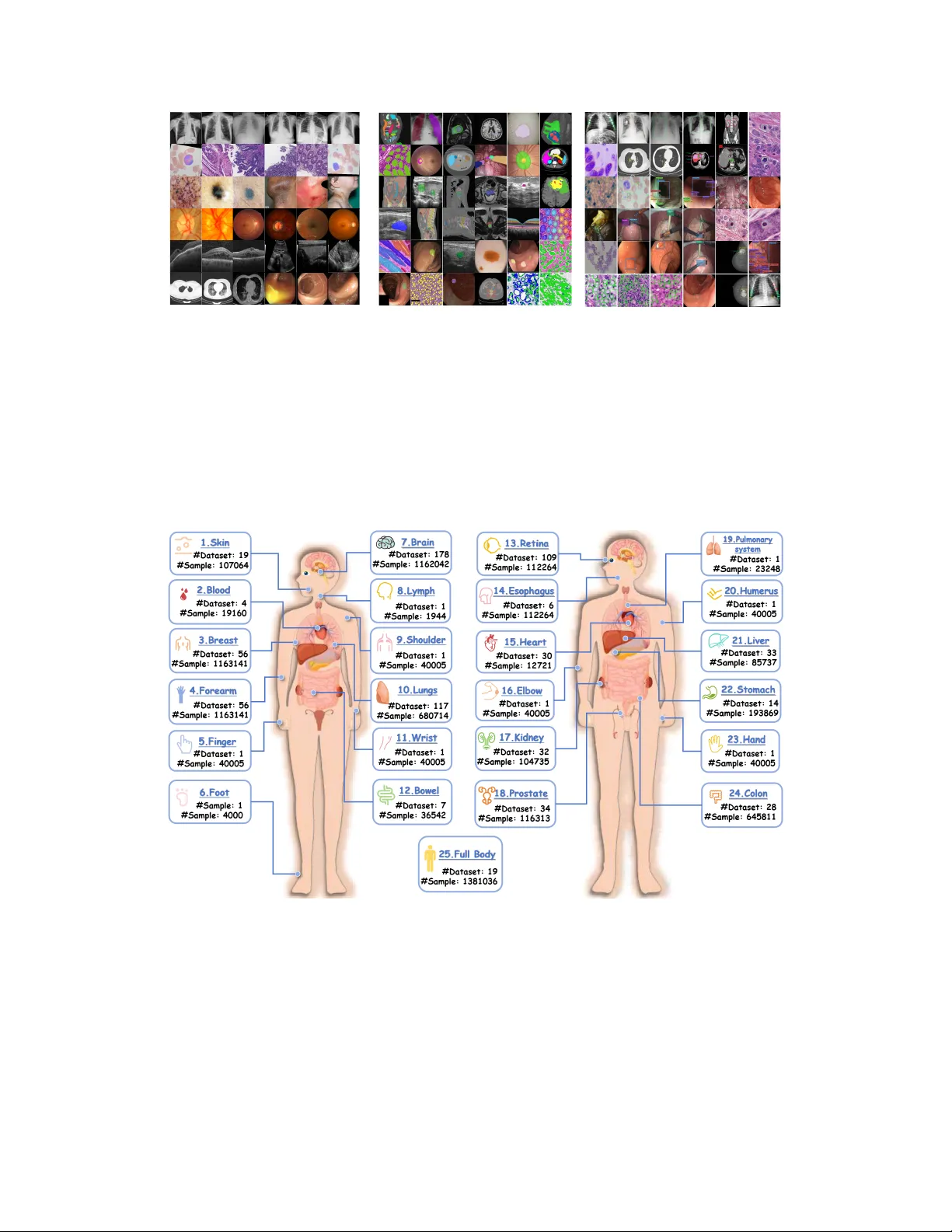 프로젝트 Imaging‑X: 1000개 이상 공개 의료 영상 데이터셋을 통한 기초 모델 스케일링 로드맵