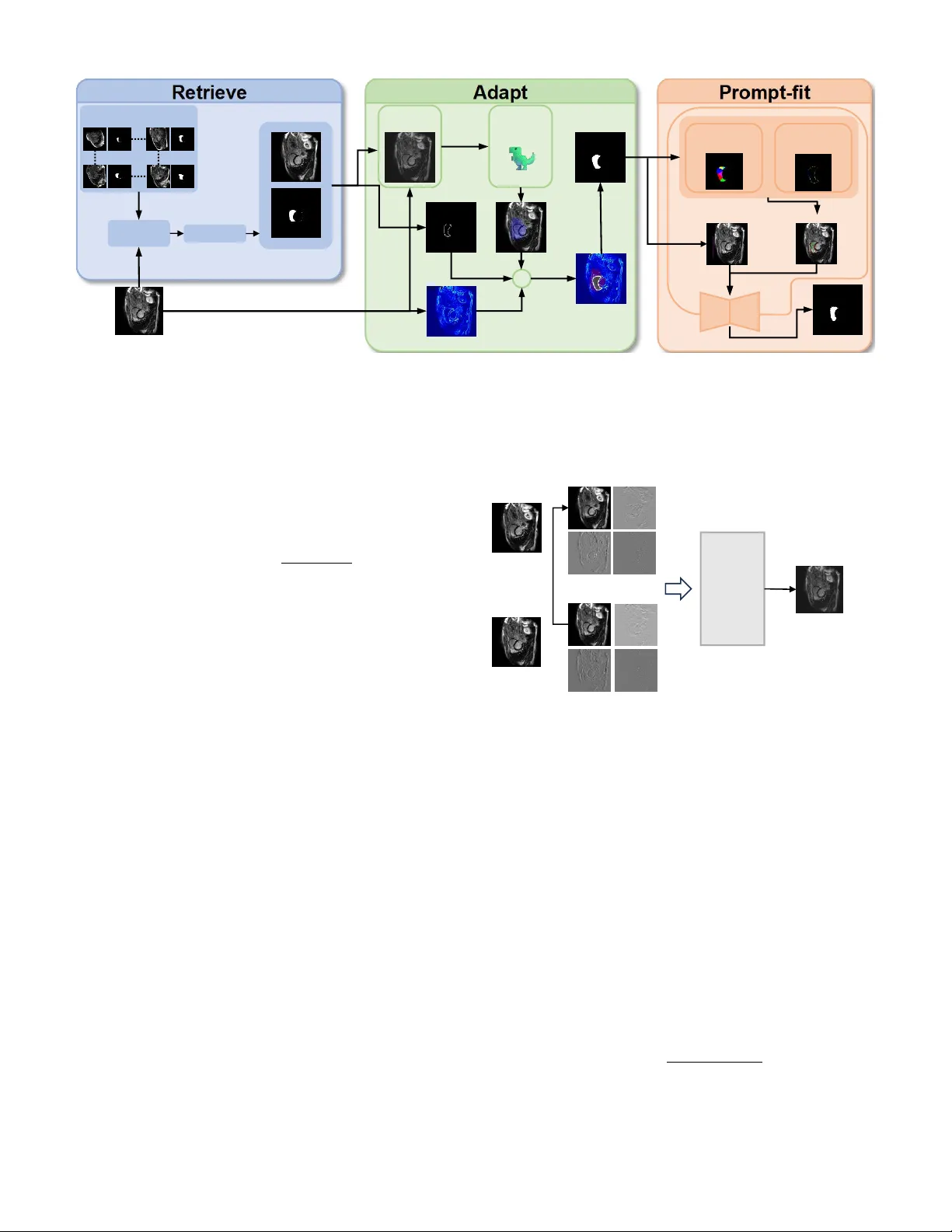 훈련 없이도 가능한 의료 영상 소수샷 분할을 위한 RAP 프레임워크