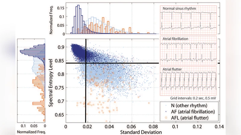 심장 리듬 이상을 빠르게 포착하는 스펙트럼 엔트로피 방법