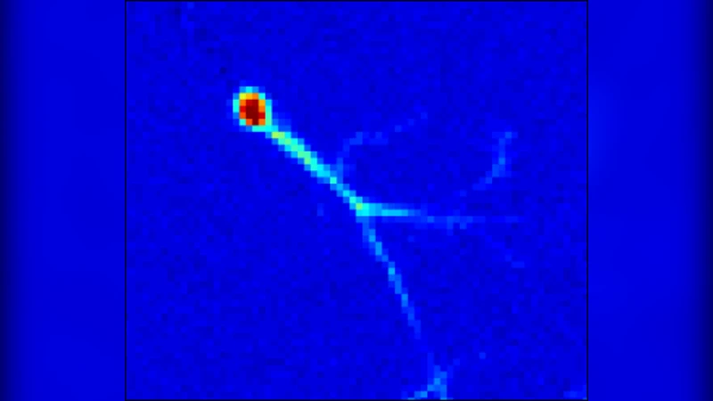 광학 흐름을 이용한 세포 신경망 칼슘 신호의 시공간 동역학 매핑