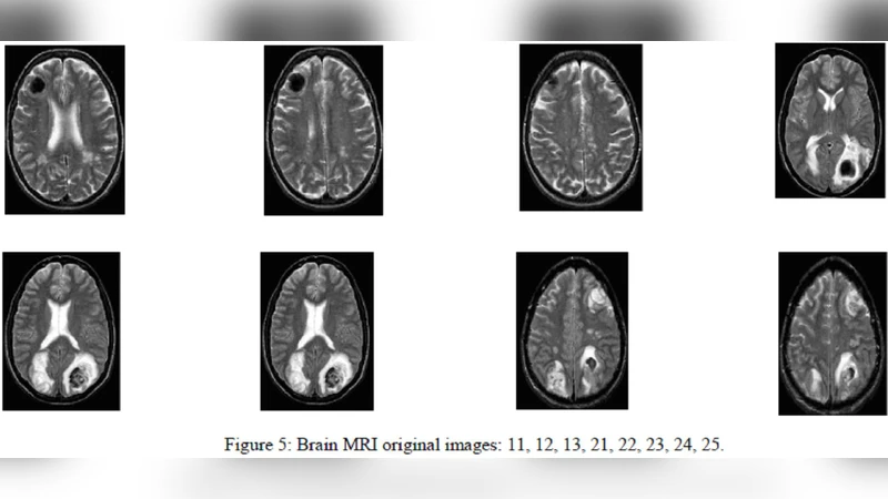 우주 감마선 투명성 이상을 풀다 초경량 축소 입자와 블레이저 방출 모델