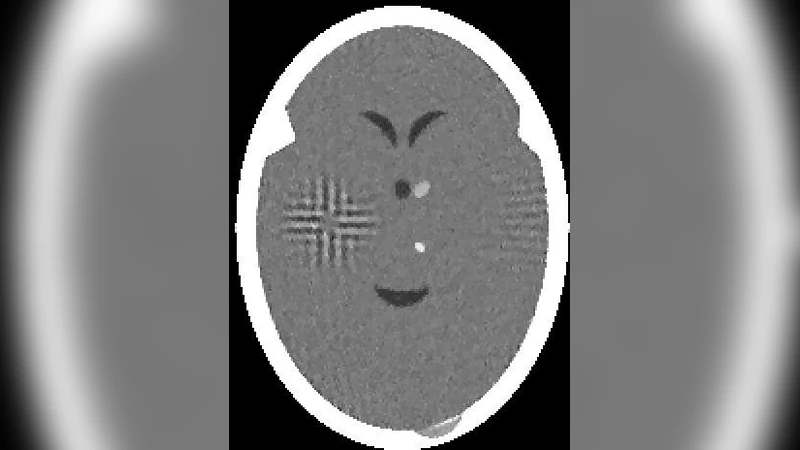 반복 알고리즘의 교란 회복성과 우수화 기법