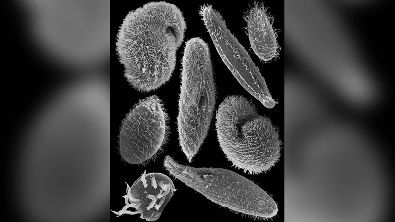 세포 골격과 움직임의 비밀