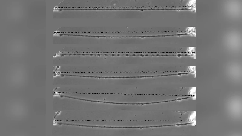 PC12 신경돌기에서 세포골격이 부피 조절 및 비드 형성에 미치는 역할