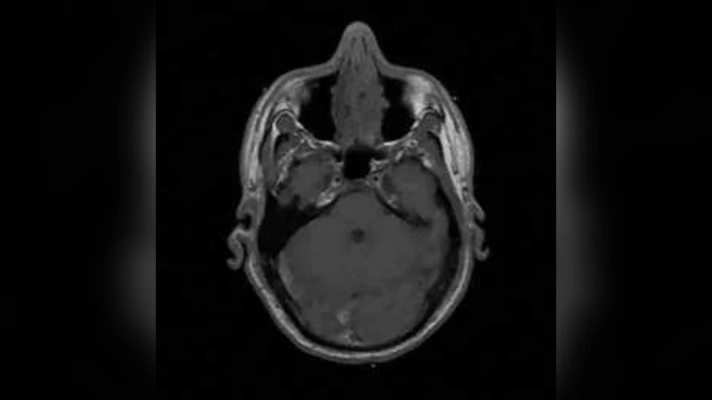 결정적 시퀀스를 이용한 순환 행렬 기반 컨볼루션 압축 센싱