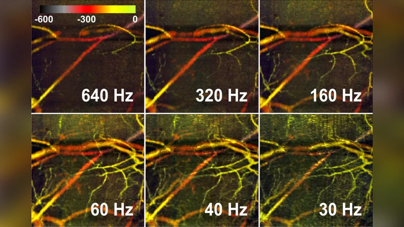 복합값 B스캔을 이용한 레퍼런스프리 3D 마이크로혈관 OCT 영상