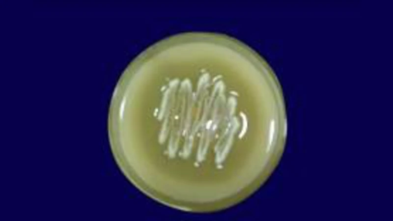 고효율 알칼리성 프로테아제 생산을 위한 Streptomyces pulvereceus 배양 최적화