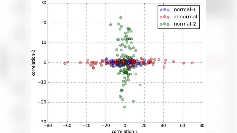 오리온 플러스 메트릭 데이터 기반 자동 문제 진단