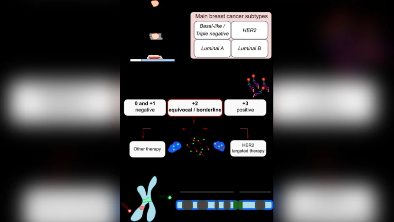 초고속 마이크로형 형광제자리잡기 조직 슬라이드 HER2 검출