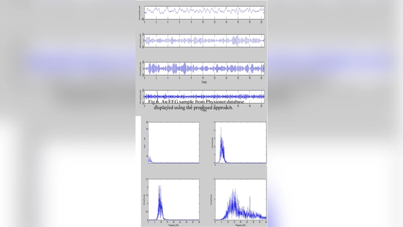 졸음운전 감지를 위한 EEG 분석과 빠른 푸리에 변환 활용