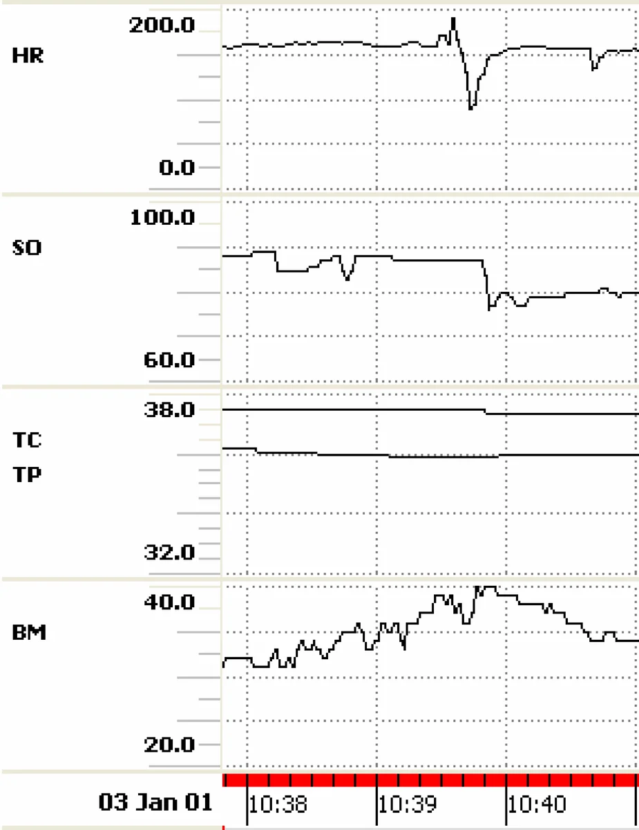 전문가 의견 합의를 위한 선형 풀링 방법