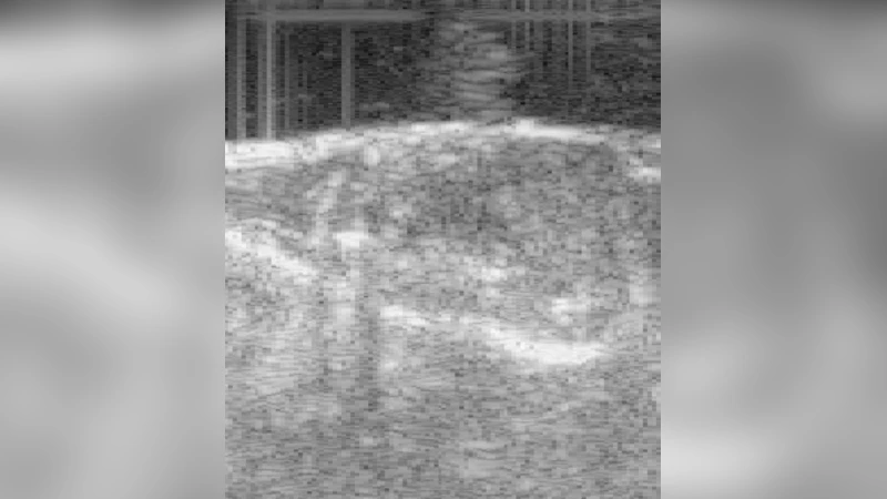 비침습적 종양 내 간질액 압력·속도·유동 분포 평가