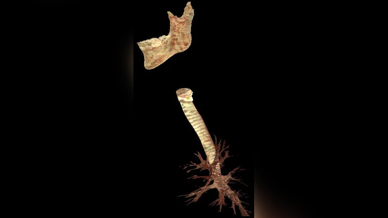 원격 의료 훈련을 위한 분산 증강현실 시스템