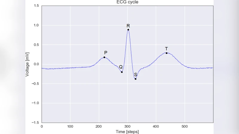 심층 순환 신경망을 이용한 ECG 신호 고성능 잡음 제거