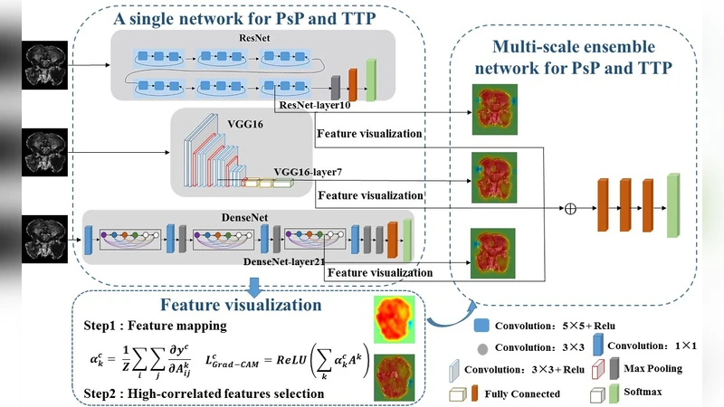 투명성 기반 앙상블 CNN으로 교모세포종 가성진행과 실제 진행 구분