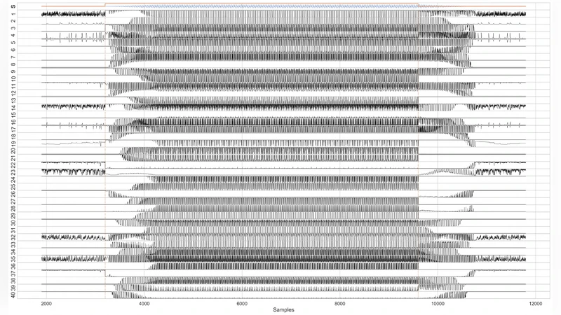 음악 악기 트랜지언트 합성을 위한 순환 신경망 조건화