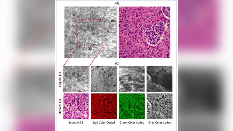 CLE 영상에 H&E 스타일을 입혀 실시간 병리학적 해석 강화