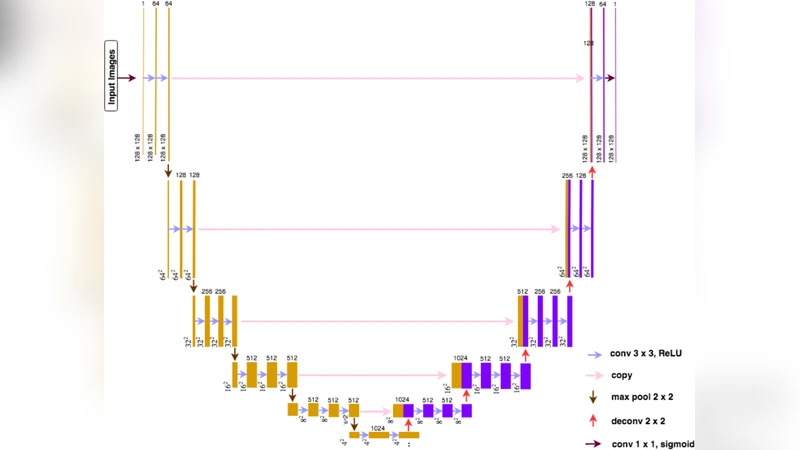 비대조 CT에서 급성 허혈성 뇌졸중의 고밀도 대뇌 중동맥 징후 자동 분할