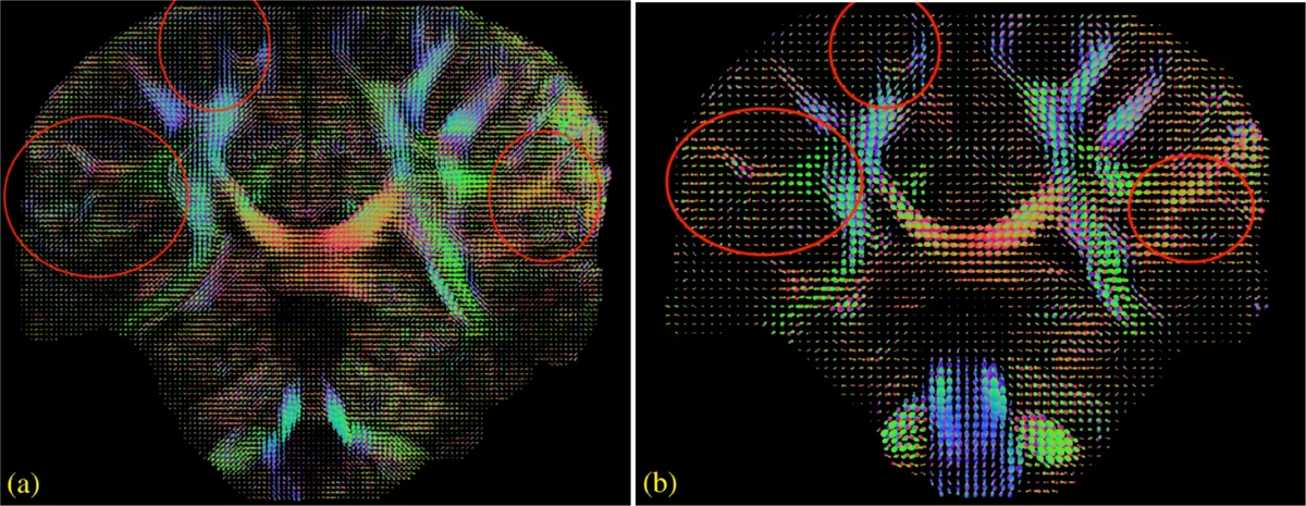 스마트 딥 복사‑붙여넣기