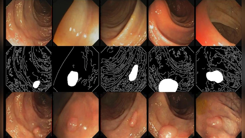 조건부 적대적 네트워크를 활용한 비정상 대장 폴립 이미지 합성 및 검출 성능 향상